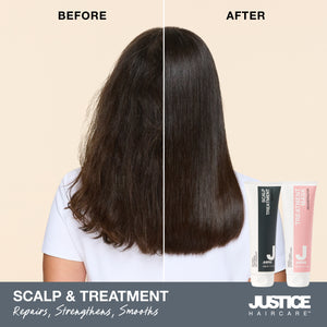 Scalp Treatment Shampoo - 1 Litre