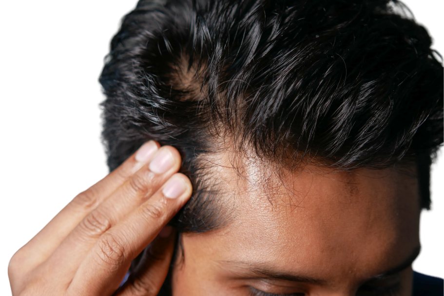 Dandruff / Scalp Health collection banner overlay